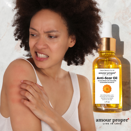 Calm & Renew Anti-Scar Oil - Eczema Relief Oil