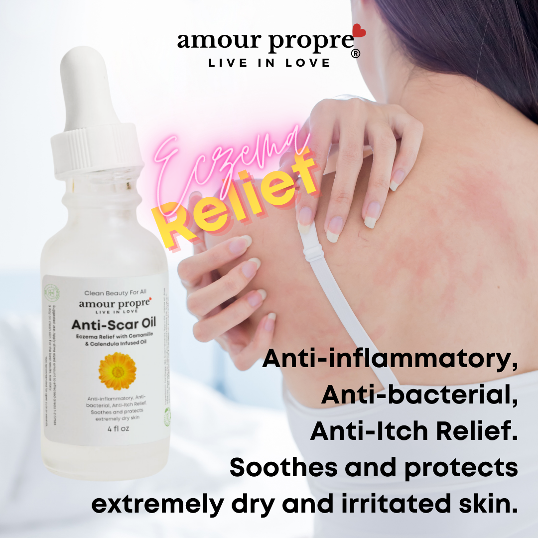 Calm & Renew Anti-Scar Oil - Eczema Relief Oil