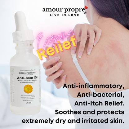 Calm & Renew Anti-Scar Oil - Eczema Relief Oil